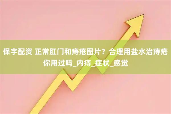 保宇配资 正常肛门和痔疮图片？合理用盐水治痔疮你用过吗_内痔_症状_感觉
